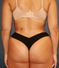 Feel Beautiful - Snatched Waist 4 - After Photo
